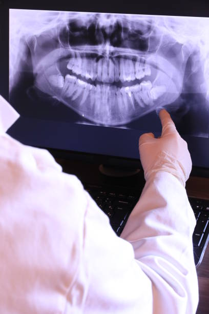 Best Emergency Root Canal Therapy in Southside, AR